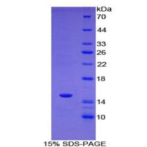 T-框蛋白3(TBX3)重组蛋白,Recombinant T-Box Protein 3 (TBX3)