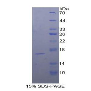 T-细胞白血病/淋巴瘤蛋白1A(TCL1A)重组蛋白