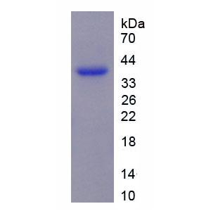 T-细胞免疫调节因子1(TCIRG1)重组蛋白,Recombinant T-Cell, Immune Regulator 1 (TCIRG1)