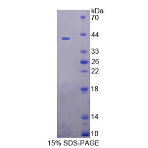 UDP-葡萄糖糖蛋白糖基转移酶1(UGGT1)重组蛋白,Recombinant UDP-Glucose Glycoprotein Glucosyltransferase 1 (UGGT1)