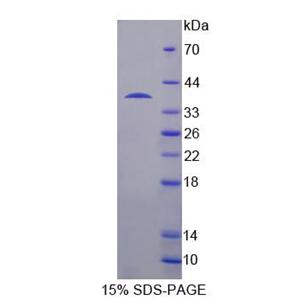 USP6氨基端样蛋白(USP6NL)重组蛋白,Recombinant USP6 N-Terminal Like Protein (USP6NL)