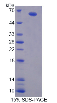 Vav1癌基因(VAV1)重組蛋白,Recombinant Vav 1 Oncogene (VAV1)