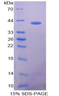 VEGF共调节趋化因子1(VCC1)重组蛋白,Recombinant VEGF Co Regulated Chemokine 1 (VCC1)