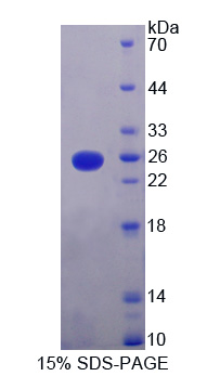 V-Ki-Ras2 Kirsten大鼠肉瘤病毒癌基因同源物(KRAS)重组蛋白,Recombinant V-Ki-Ras2 Kirsten Rat Sarcoma Viral Oncogene Homolog (KRAS)