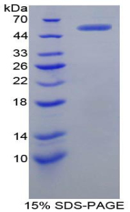 V-Myc骨髓細胞瘤病毒癌基因同源物(MYC)重組蛋白,Recombinant V-Myc Myelocytomatosis Viral Oncogene Homolog (MYC)