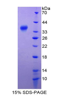 V-Rel网状内皮增生病毒癌基因同源物A(RELA)重组蛋白,Recombinant V-Rel Reticuloendotheliosis Viral Oncogene Homolog A (RELA)