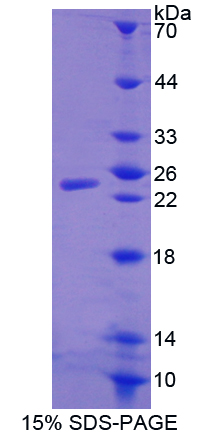 WAP四二硫化物核心域蛋白1(WFDC1)重組蛋白,Recombinant WAP Four Disulfide Core Domain Protein 1 (WFDC1)