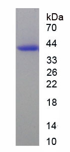 WNK賴氨酸缺乏蛋白激酶1(WNK1)重組蛋白,Recombinant WNK Lysine Deficient Protein Kinase 1 (WNK1)