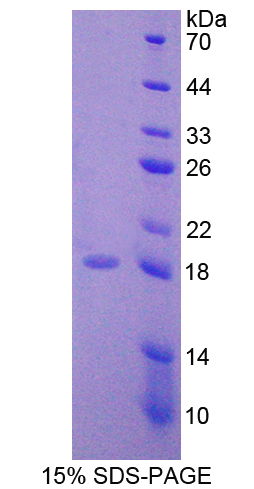 WNT1誘導(dǎo)信號(hào)通道蛋白1(WISP1)重組蛋白,Recombinant WNT1 Inducible Signaling Pathway Protein 1 (WISP1)