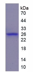 WNT1诱导信号通道蛋白2(WISP2)重组蛋白,Recombinant WNT1 Inducible Signaling Pathway Protein 2 (WISP2)