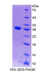 WNT抑制因子1(WIF1)重组蛋白,Recombinant WNT Inhibitory Factor 1 (WIF1)