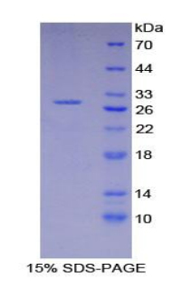 X-射线修复交叉互补蛋白6(XRCC6)重组蛋白,Recombinant X-Ray Repair Cross Complementing 6 (XRCC6)