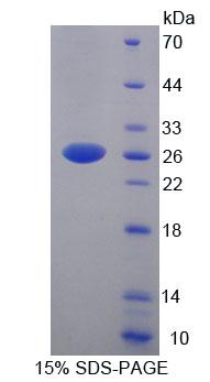 YY1关联因子2(YAF2)重组蛋白,Recombinant YY1 Associated Factor 2 (YAF2)