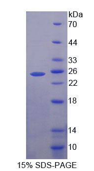 Zeste同源物增强子1(EZH1)重组蛋白,Recombinant Enhancer Of Zeste Homolog 1 (EZH1)