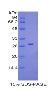 α2-HS糖蛋白(AHSG)重组蛋白,Recombinant Alpha-2-Heremans Schmid Glycoprotein (AHSG)