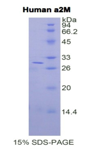 α2-巨球蛋白(a2M)重組蛋白,Recombinant Alpha-2-Macroglobulin (a2M)