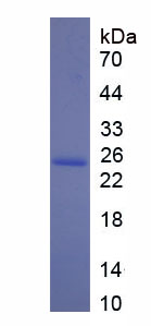 癌/睾丸抗原1B(CTAG1B)重组蛋白,Recombinant Cancer/Testis Antigen 1B (CTAG1B)