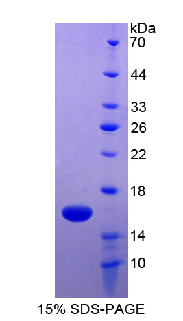 癌胚抗原相关细胞粘附分子6(CEACAM6)重组蛋白,Recombinant Carcinoembryonic Antigen Related Cell Adhesion Molecule 6 (CEACAM6)