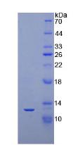 氨基端前脑钠素(NT-ProBNP)重组蛋白,Recombinant N-Terminal Pro-Brain Natriuretic Peptide (NT-ProBNP)