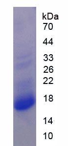 氨基端前心钠肽(NT-ProANP)重组蛋白,Recombinant N-Terminal Pro-Atrial Natriuretic Peptide (NT-ProANP)