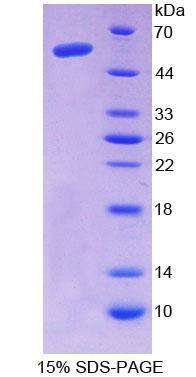 氨基乙二酸半醛合酶(AASS)重組蛋白,Recombinant Aminoadipate Semialdehyde Synthase (AASS)