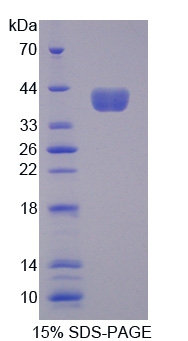 氨基乙二酸半醛磷酸泛酰巰基乙胺基轉移酶(AASDHPPT)重組蛋白,Recombinant Aminoadipate Semialdehyde Phosphopantetheinyl Transferase (AASDHPPT)