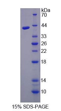 氨乙酰丙酸δ脱水酶(ALAD)重组蛋白,Recombinant Aminolevulinate Delta Dehydratase (ALAD)