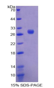 八聚體結(jié)合轉(zhuǎn)錄因子2(OCT2)重組蛋白,Recombinant Octamer Binding Transcription Factor 2 (OCT2)