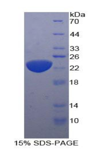 白介素11(IL11)重组蛋白,Recombinant Interleukin 11 (IL11)