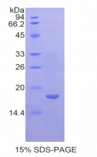 白介素17受体A(IL17RA)重组蛋白,Recombinant Interleukin 17 Receptor A (IL17RA)
