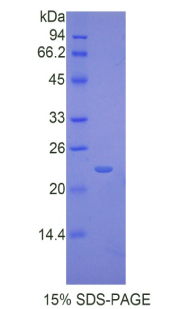 白介素17受体B(IL17RB)重组蛋白,Recombinant Interleukin 17 Receptor B (IL17RB)