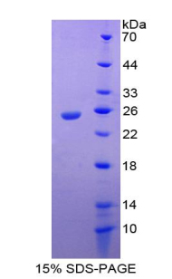 白介素17受體E(IL17RE)重組蛋白,Recombinant Interleukin 17 Receptor E (IL17RE)