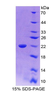 白介素18(IL18)重组蛋白,Recombinant Interleukin 18 (IL18)