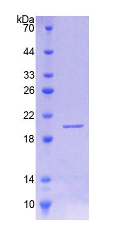 白介素18结合蛋白(IL18BP)重组蛋白,Recombinant Interleukin 18 Binding Protein (IL18BP)