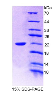 白介素19(IL19)重組蛋白,Recombinant Interleukin 19 (IL19)