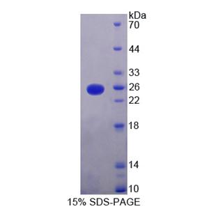 V-Ki-Ras2 Kirsten大鼠肉瘤病毒癌基因同源物(KRAS)重组蛋白