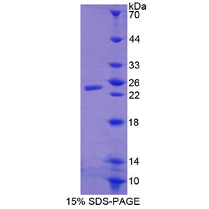 WAP四二硫化物核心域蛋白1(WFDC1)重组蛋白