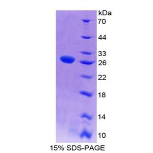 WNT抑制因子1(WIF1)重组蛋白,Recombinant WNT Inhibitory Factor 1 (WIF1)