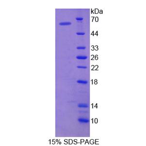 X-连锁凋亡蛋白抑制因子(XIAP)重组蛋白
