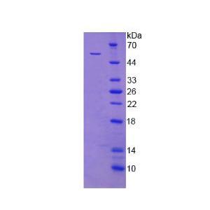 X-射线修复交叉互补蛋白5(XRCC5)重组蛋白,XRCC5