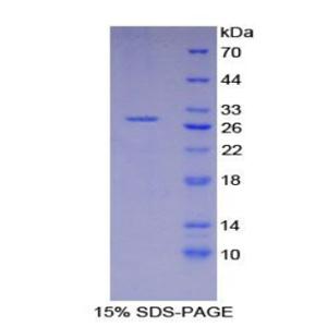 X-射线修复交叉互补蛋白6(XRCC6)重组蛋白