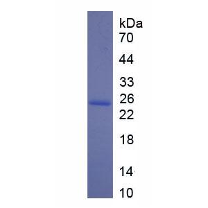 癌/睾丸抗原1B(CTAG1B)重组蛋白