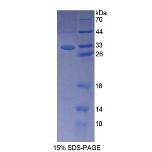 癌亮氨酸拉链下调节因子1(LDOC1)重组蛋白