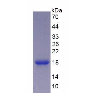 癌胚抗原(CEA)重组蛋白