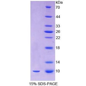 癌调蛋白(OCM)重组蛋白,Recombinant Oncomodulin (OCM)