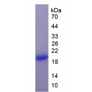 安定结合抑制因子(DBI)重组蛋白