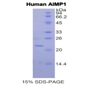 氨酰tRNA合成酶复合多功能相互作用蛋白1(AIMP1)重组蛋白