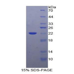 白介素10(IL10)重组蛋白