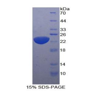 白介素11(IL11)重组蛋白