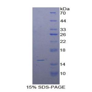 白介素15(IL15)重组蛋白